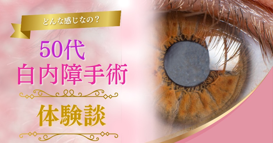 50代白内障手術体験談のアイキャッチ画像